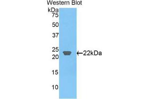 Western blot analysis of the recombinant protein. (CLEC3B antibody  (AA 22-202))