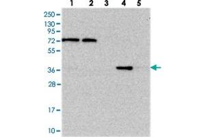 Western blot analysis of Lane 1: RT-4, Lane 2: U-251 MG, Lane 3: Human Plasma, Lane 4: Liver, Lane 5: Tonsil with C11orf54 polyclonal antibody .