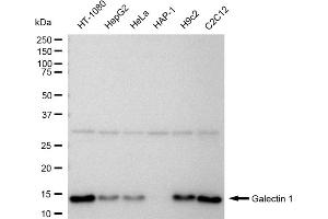 Western blotting analysis using Galectin 1 antibody (ABIN7799243). (Recombinant LGALS1/Galectin 1 antibody)