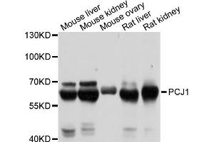 Western blot analysis of extracts of various cell lines, using PCK1 antibody (ABIN5971068) at 1/1000 dilution. (PCK1 antibody)