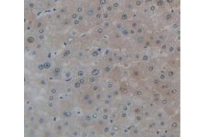 IHC-P analysis of Human Tissue, with DAB staining. (VRK1 antibody  (AA 46-292))