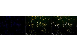 Immunocytochemistry/Immunofluorescence analysis using Rabbit Anti-Rab5 Polyclonal Antibody (ABIN361845 and ABIN361846). (RAB5 antibody)