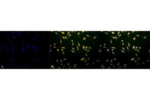 Immunocytochemistry/Immunofluorescence analysis using Rabbit Anti-Rab5 Polyclonal Antibody (ABIN361845 and ABIN361846).