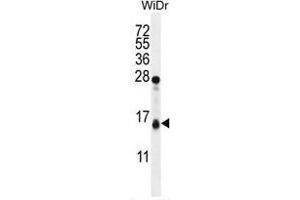 TOMM20L Antibody (N-term) western blot analysis in WiDr cell line lysates (35 µg/lane).