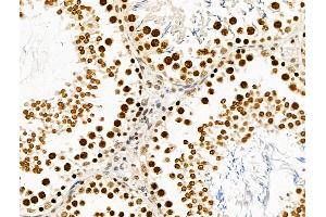 ABIN6265482 and ABIN6269020 at 1/100 staining Rat testis tissue by IHC-P. (TBP antibody  (N-Term))