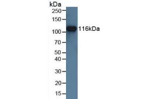 Detection of MUSK in Human Jurkat Cells using Polyclonal Antibody to Muscle, Skeletal, Receptor Tyrosine Kinase (MUSK) (MUSK antibody  (AA 517-777))
