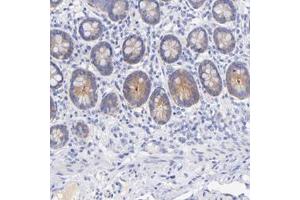 Immunohistochemical staining of human small intestine with GPHN polyclonal antibody  shows cytoplasmic positivity in glandular cells. (Gephyrin antibody)