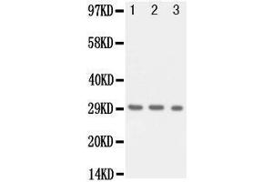 Anti-Kallikrein 1 antibody, Western blotting Lane 1: Recombinant Human KLK1 Protein 10ng Lane 2: Recombinant Human KLK1 Protein 5ng Lane 3: Recombinant Human KLK1 Protein 2. (Kallikrein 1 antibody  (Middle Region))