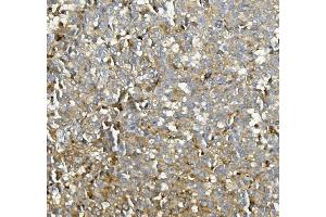 IHC analysis of ASAH1 using anti-ASAH1 antibody (ABIN7602206). (ASAH1 antibody  (AA 63-393))