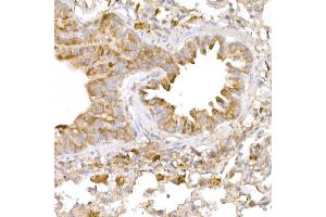Immunohistochemistry (IHC) image for anti-BRCA1 Associated Protein-1 (Ubiquitin Carboxy-terminal Hydrolase) (BAP1) (AA 460-729) antibody (ABIN6137447)