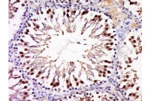 Paraformaldehyde-fixed, paraffin embedded rat testis, Antigen retrieval by boiling in sodium citrate buffer (pH6) for 15min, Block endogenous peroxidase by 3% hydrogen peroxide for 30 minutes, Blocking buffer (normal goat serum) at 37°C for 20min, Antibody incubation with Rabbit Anti-ANKRD28 Polyclonal Antibody, Unconjugated  at 1:500 overnight at 4°C, followed by a conjugated secondary and DAB staining. (ANKRD28 antibody  (AA 430-530))