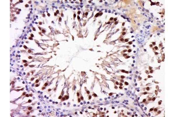 ANKRD28 antibody  (AA 430-530)