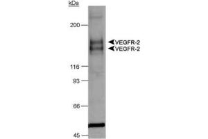 Image no. 2 for anti-Fms-Related tyrosine Kinase 1 (VEGFR1) (FLT1) (AA 800-900), (Internal Region) antibody (ABIN363475)