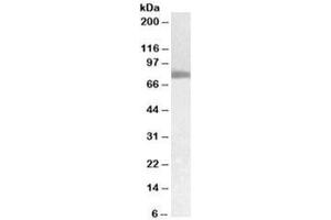 Western blot testing of human pancreas cancer lysate with TGM2 antibody at 0. (Transglutaminase 2 antibody)