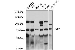 Western blot analysis of extracts of various cell lines, using OS9 antibody (ABIN6131415, ABIN6145063, ABIN6145064 and ABIN6215868) at 1:3000 dilution. (OS9 antibody  (AA 353-612))