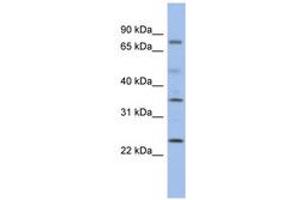 Image no. 1 for anti-Protein Phosphatase, Mg2+/Mn2+ Dependent, 1K (PPM1K) (C-Term) antibody (ABIN6743697) (PPM1K antibody  (C-Term))