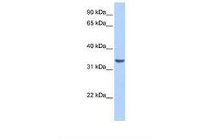 Image no. 1 for anti-RAB40A, Member RAS Oncogene Family (RAB40A) (AA 185-234) antibody (ABIN6739365) (RAB40A antibody  (AA 185-234))