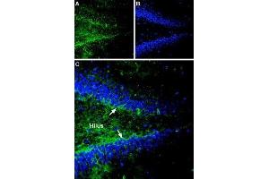 Expression of Gephyrin in rat hippocampus - Immunohistochemical staining of rat hippocampal dentate gyrus sections using Anti-Gephyrin Antibody (ABIN7043214, ABIN7044520 and ABIN7044521). (Gephyrin antibody  (Intracellular))