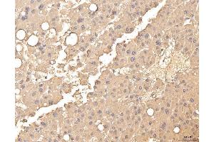 IHC analysis of BHMT using anti-BHMT antibody (ABIN7599940). (BHMT antibody  (AA 13-386))