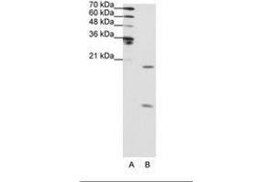Image no. 2 for anti-Small Nuclear Ribonucleoprotein Polypeptide F (SNRPF) (N-Term) antibody (ABIN202012) (SNRPF antibody  (N-Term))