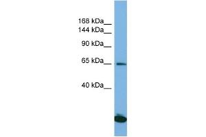 Host: Rabbit Target Name: SAP130 Sample Type: Jurkat Whole Cell lysates Antibody Dilution: 1.