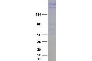Validation with Western Blot (TDRD6 Protein (Myc-DYKDDDDK Tag))