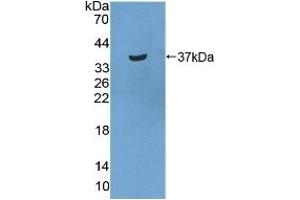 Detection of Recombinant STATH, Human using Polyclonal Antibody to Statherin (STATH) (STATH antibody  (AA 1-62))