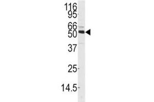 Western blot analysis of CAMKK1 antibody and mouse thymus tissue lysate. (CAMKK1 antibody  (AA 337-369))