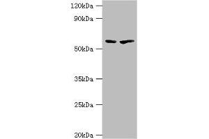 Western blot All lanes: 5-aminolevulinate synthase, erythroid-specific, mitochondrial antibody at 7 μg/mL Lane 1: 293T whole cell lysate Lane 2: Mouse brain tissue Secondary Goat polyclonal to rabbit IgG at 1/10000 dilution Predicted band size: 65, 61, 50, 64 kDa Observed band size: 65 kDa