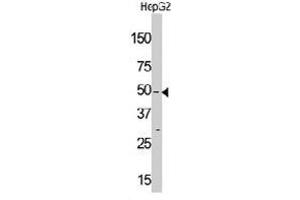 Western blot analysis of MLKLAK polyclonal antibody  in HepG2 cell line lysate (35 ug/lane). (ZAK antibody  (Internal Region))