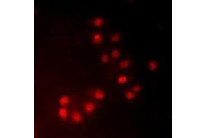 Immunofluorescent analysis of MKI67IP (pT234) staining in HeLa cells. (NIFK antibody  (pSer234))