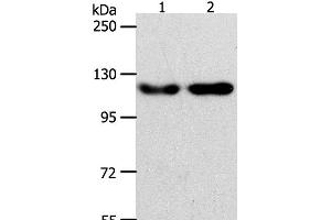 Western Blot analysis of Hela and Jurkat cell using ABL2 Polyclonal Antibody at dilution of 1:400 (ABL2 antibody)