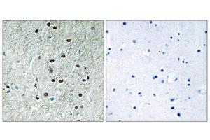 Immunohistochemistry analysis of paraffin-embedded human brain tissue using REXO1 antibody. (REXO1 antibody  (Internal Region))