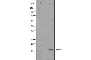 Western blot analysis of Blood  lysate using TTR antibody. (TTR antibody  (C-Term))