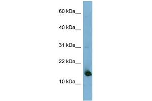 WB Suggested Anti-MED31 Antibody Titration: 0. (MED31 antibody  (N-Term))