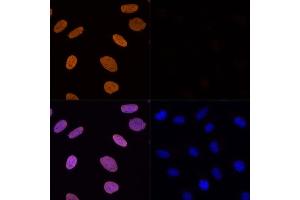 Immunofluorescence analysis of U-2 OS cells using Acetyl-Histone H3-K56 Rabbit pAb (ABIN7267674) at dilution of 100 (40x lens). (Histone 3 antibody  (H3K56))