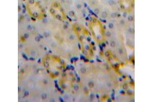 Used in DAB staining on fromalin fixed paraffin-embedded Kidney tissue (CLIC4 antibody  (AA 104-253))