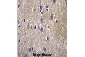 CPN2 Antibody (N-term) (ABIN657122 and ABIN2846266) immunohistochemistry analysis in formalin fixed and paraffin embedded human brain tissue followed by peroxidase conjugation of the secondary antibody and DAB staining.