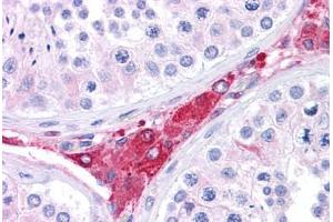 Human Testis: Formalin-Fixed, Paraffin-Embedded (FFPE) (BACE1 antibody  (AA 72-121))