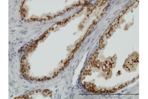 Immunoperoxidase of monoclonal antibody to FOXA1 on formalin-fixed paraffin-embedded human prostate. (FOXA1 antibody  (AA 367-472))