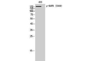 Western Blotting (WB) image for anti-Epidermal Growth Factor Receptor (EGFR) (pTyr869) antibody (ABIN3181991) (EGFR antibody  (pTyr869))