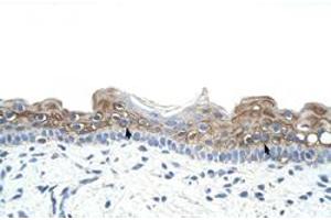 Immunohistochemical staining (Formalin-fixed paraffin-embedded sections) of human skin with DAZ2 polyclonal antibody  at 4-8 ug/mL working concentration. (DAZ2 antibody  (N-Term))