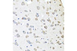 Immunohistochemistry of paraffin-embedded mouse brain using APCS antibody (ABIN5971040) at dilution of 1/100 (40x lens). (APCS antibody)