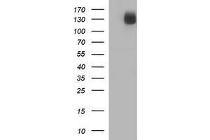 Image no. 2 for anti-CD163 (CD163) antibody (ABIN1497175)
