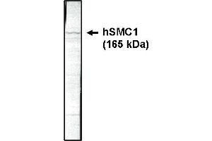 Western blotting using SMC1 antibody on HeLa cell lysate at 1 µg/ml. (SMC1A antibody  (AA 402-894))
