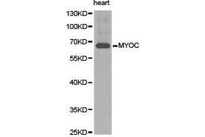 Western Blotting (WB) image for anti-Myocilin (MYOC) antibody (ABIN1873807) (MYOC antibody)