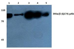Western blot(WB) analysis of IKKα/β antibody at 1/500 dilution (IKK alpha antibody)