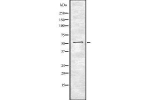 Western blot analysis of AGT using K562 whole  lysates.