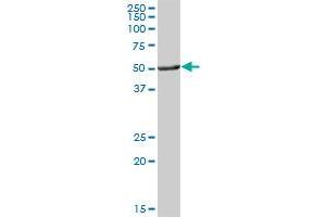 ALDH3A1 MaxPab polyclonal antibody. (ALDH3A1 antibody  (AA 1-453))