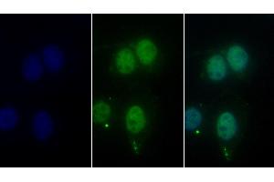 Detection of HDAC1 in Human Hela cell using Monoclonal Antibody to Histone Deacetylase 1 (HDAC1) (HDAC1 antibody  (AA 1-482))